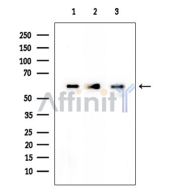 METTL3 Mouse Monoclonal Antibody - Western blot analysis of extracts from various samples, using METTL3 Mouse Monoclonal Antibody at 1/1000 dilution.