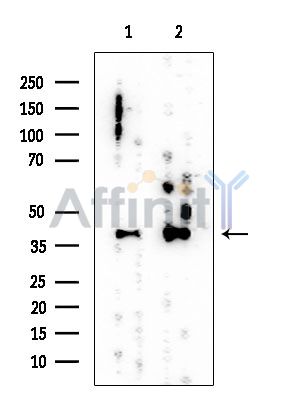 Nucleophosmin Mouse Monoclonal Antibody - Western blot analysis of extracts from various samples, using Nucleophosmin Mouse Monoclonal Antibody at 1/1000 dilution.