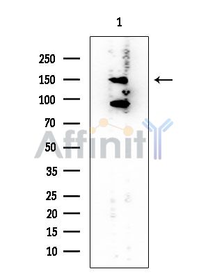 Liprin alpha 1 Mouse Monoclonal Antibody - Western blot analysis of extracts from Rat testis, using Liprin alpha 1 Mouse Monoclonal Antibody at 1/1000 dilution.