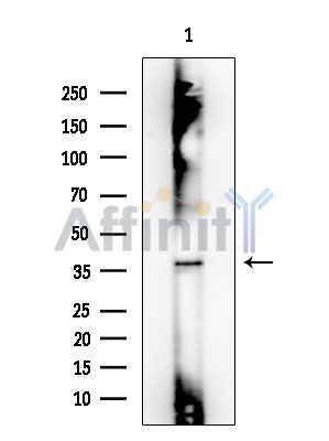 AKR7A2 Mouse Monoclonal Antibody - Western blot analysis of extracts from Mouse lung, using AKR7A2 Mouse Monoclonal Antibody at 1/1000 dilution.