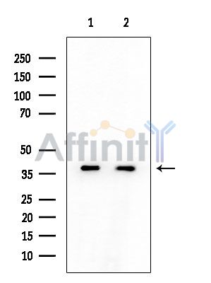 AKR7A2 Mouse Monoclonal Antibody - Western blot analysis of extracts from various samples, using AKR7A2 Mouse Monoclonal Antibody at 1/1000 dilution.