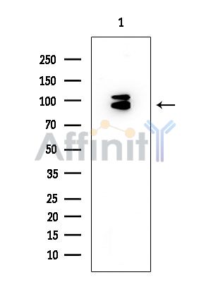 PBXIP1 Mouse Monoclonal Antibody - Western blot analysis of extracts from EC304 cells, using PBXIP1 Mouse Monoclonal Antibody at 1/1000 dilution.