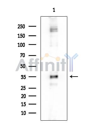 PPA1 Mouse Monoclonal Antibody - Western blot analysis of extracts from COLO205 cells, using PPA1 Mouse Monoclonal Antibody at 1/1000 dilution.