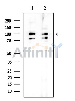 ELAC2 Mouse Monoclonal Antibody - Western blot analysis of extracts from various samples, using ELAC2 Mouse Monoclonal Antibody at 1/1000 dilution.
