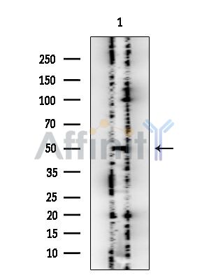 PSMD4 Mouse Monoclonal Antibody - Western blot analysis of extracts from Rat testis, using PSMD4 Mouse Monoclonal Antibody at 1/1000 dilution.
