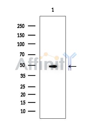 VPS37A Mouse Monoclonal Antibody - Western blot analysis of extracts from EC304 cells, using VPS37A Mouse Monoclonal Antibody at 1/1000 dilution.