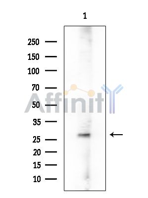 CA3 Mouse Monoclonal Antibody - Western blot analysis of extracts from Rat testis, using CA3 Mouse Monoclonal Antibody at 1/1000 dilution.