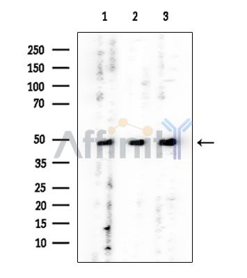 GTPBP5 Mouse Monoclonal Antibody - Western blot analysis of extracts from various samples, using GTPBP5 Mouse Monoclonal Antibody at 1/1000 dilution.