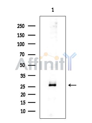 APCS Mouse Monoclonal Antibody - Western blot analysis of extracts from Mouse lung, using APCS Mouse Monoclonal Antibody at 1/1000 dilution.