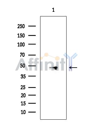 PSMC3 Mouse Monoclonal Antibody - Western blot analysis of extracts from EC304 cells, using PSMC3 Mouse Monoclonal Antibody at 1/1000 dilution.