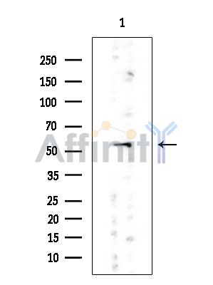 ALDH7A1 Mouse Monoclonal Antibody - Western blot analysis of extracts from Rat testis, using ALDH7A1 Mouse Monoclonal Antibody at 1/1000 dilution.