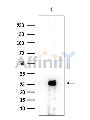 GSTM5 Mouse Monoclonal Antibody - Western blot analysis of extracts from Rat testis, using GSTM5 Mouse Monoclonal Antibody at 1/1000 dilution.
