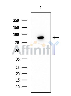 ADAM32 Mouse Monoclonal Antibody - Western blot analysis of extracts from EC304 cells, using ADAM32 Mouse Monoclonal Antibody at 1/1000 dilution.