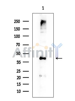 B3GALT4 Mouse Monoclonal Antibody - Western blot analysis of extracts from EC304 cells, using B3GALT4 Mouse Monoclonal Antibody at 1/1000 dilution.