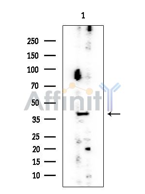 THA11 Mouse Monoclonal Antibody - Western blot analysis of extracts from EC304 cells, using THA11 Mouse Monoclonal Antibody at 1/1000 dilution.