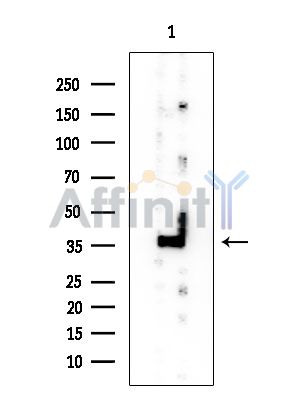 THA11 Mouse Monoclonal Antibody - Western blot analysis of extracts from COLO205 cells, using THA11 Mouse Monoclonal Antibody at 1/1000 dilution.