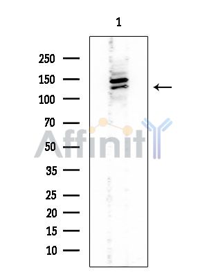 HCN4 Mouse Monoclonal Antibody - Western blot analysis of extracts from EC304 cells, using HCN4 Mouse Monoclonal Antibody at 1/1000 dilution.