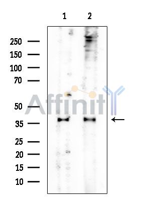 IDH3A Mouse Monoclonal Antibody - Western blot analysis of extracts from various samples, using IDH3A Mouse Monoclonal Antibody at 1/1000 dilution.