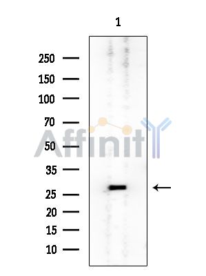 MRPS7 Mouse Monoclonal Antibody - Western blot analysis of extracts from Rat testis, using MRPS7 Mouse Monoclonal Antibody at 1/1000 dilution.