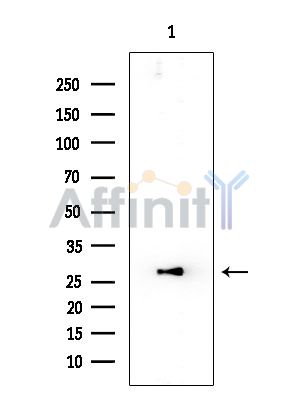 MRPS7 Mouse Monoclonal Antibody - Western blot analysis of extracts from EC304 cells, using MRPS7 Mouse Monoclonal Antibody at 1/1000 dilution.