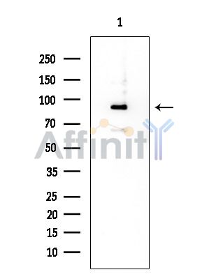 TRPC1 Mouse Monoclonal Antibody - Western blot analysis of extracts from COLO205 cells, using TRPC1 Mouse Monoclonal Antibody at 1/1000 dilution.