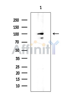 DDX10 Mouse Monoclonal Antibody - Western blot analysis of extracts from COLO205 cells, using DDX10 Mouse Monoclonal Antibody at 1/1000 dilution.