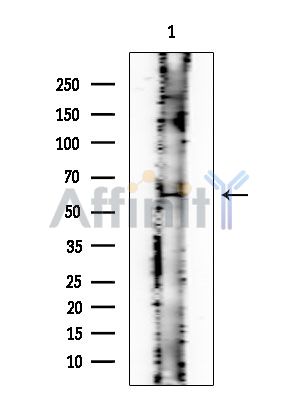 CRMP5 Mouse Monoclonal Antibody - Western blot analysis of extracts from EC304 cells, using CRMP5 Mouse Monoclonal Antibody at 1/1000 dilution.