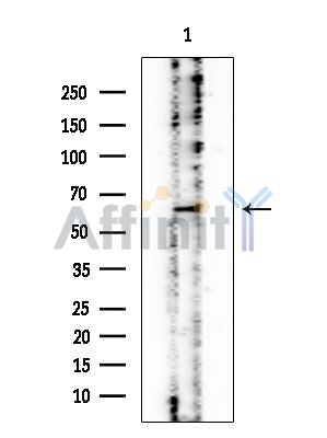 CRMP5 Mouse Monoclonal Antibody - Western blot analysis of extracts from Rat testis, using CRMP5 Mouse Monoclonal Antibody at 1/1000 dilution.
