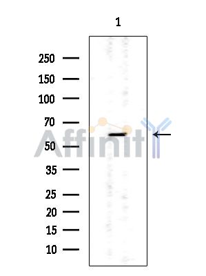 CRMP5 Mouse Monoclonal Antibody - Western blot analysis of extracts from Mouse lung, using CRMP5 Mouse Monoclonal Antibody at 1/1000 dilution.