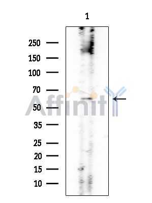 PPP3CB Mouse Monoclonal Antibody - Western blot analysis of extracts from Mouse lung, using PPP3CB Mouse Monoclonal Antibody at 1/1000 dilution.