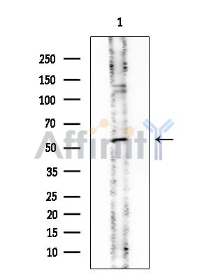 PPP3CB Mouse Monoclonal Antibody - Western blot analysis of extracts from EC304 cells, using PPP3CB Mouse Monoclonal Antibody at 1/1000 dilution.