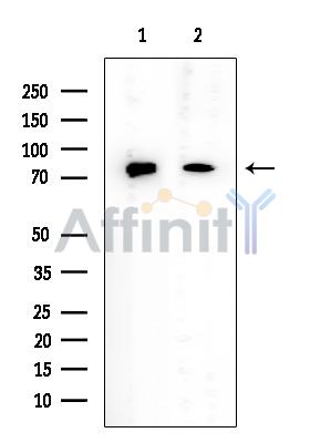 DDX17 Mouse Monoclonal Antibody - Western blot analysis of extracts from various samples, using DDX17 Mouse Monoclonal Antibody at 1/1000 dilution.