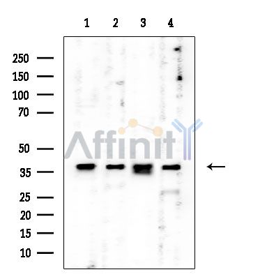CAPG Mouse Monoclonal Antibody - Western blot analysis of extracts from various samples, using CAPG Mouse Monoclonal Antibody at 1/1000 dilution.