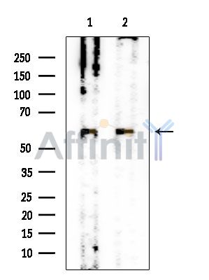 CSGALNACT1 Mouse Monoclonal Antibody - Western blot analysis of extracts from various samples, using CSGALNACT1 Mouse Monoclonal Antibody at 1/1000 dilution.
