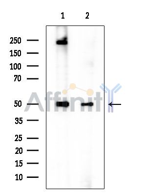 CCT4 Mouse Monoclonal Antibody - Western blot analysis of extracts from various samples, using CCT4 Mouse Monoclonal Antibody at 1/1000 dilution.