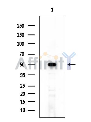 CCT4 Mouse Monoclonal Antibody - Western blot analysis of extracts from EC304 cells, using CCT4 Mouse Monoclonal Antibody at 1/1000 dilution.