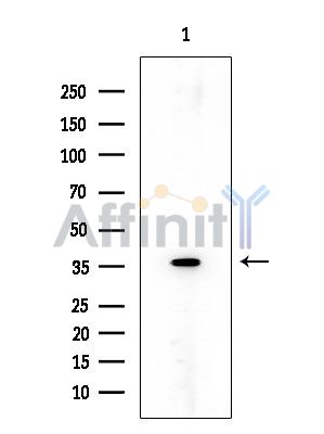 Peropsin Mouse Monoclonal Antibody - Western blot analysis of extracts from COLO205 cells, using Peropsin Mouse Monoclonal Antibody at 1/1000 dilution.