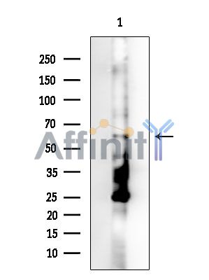 WIPF1 Antibody - Western blot analysis of extracts from EC304 cells(UV treatment), using WIPF1 Antibody.