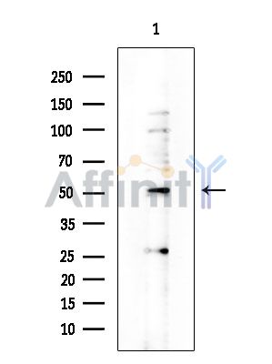 HAT Antibody - Western blot analysis of extracts from COLO205 cells, using HAT Antibody at 1/1000 dilution.