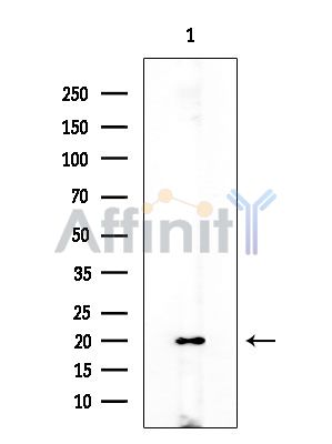 CDKA1 / DOC1 Antibody - Western blot analysis of extracts from Rat brain, using CDKA1 / DOC1 Antibody at 1/1000 dilution.