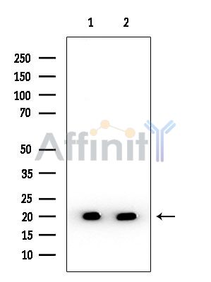 CDKA1 / DOC1 Antibody - Western blot analysis of extracts from various samples, using CDKA1 / DOC1 Antibody at 1/1000 dilution.