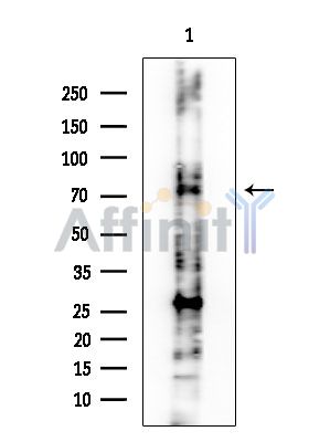 TAF6L Antibody - Western blot analysis of extracts from Rat brain, using TAF6L Antibody at 1/1000 dilution.