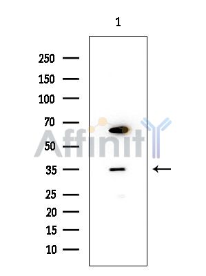 Phospho-TNNI3 (Thr143) Antibody - Western blot analysis of extracts from COLO205 cells, using Phospho-TNNI3 (Thr143) Antibody at 1/1000 dilution.