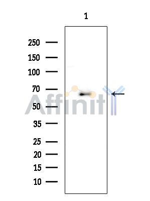 Phospho-Paxillin (Tyr31) Antibody - Western blot analysis of extracts from COLO205 cells, using Phospho-Paxillin (Tyr31) Antibody at 1/1000 dilution.