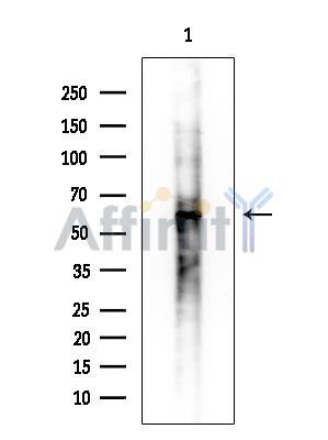 Phospho-p62Dok (Tyr362) Antibody - Western blot analysis of extracts from COLO205 cells, using Phospho-p62Dok (Tyr362) Antibody at 1/1000 dilution.