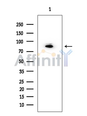 LGR5 Antibody - Western blot analysis of extracts from EC304 cells, using LGR5 Antibody at 1/1000 dilution.