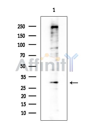 HOXB5 Antibody - Western blot analysis of extracts from Rat brain, using HOXB5 Antibody at 1/1000 dilution.