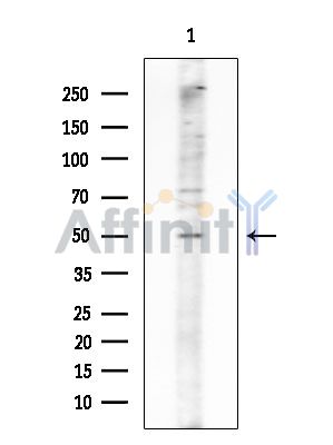Dematin Antibody - Western blot analysis of extracts from HUVEC cells, using Dematin Antibody at 1/1000 dilution.