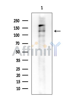 Phospho-TERT (Ser824) Antibody - Western blot analysis of extracts from Rat brain, using Phospho-TERT (Ser824) Antibody at 1/1000 dilution.