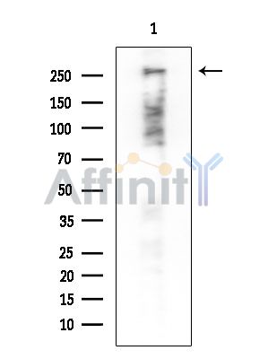 P300/CBP Antibody - Western blot analysis of extracts from Rat brain, using P300/CBP Antibody at 1/1000 dilution.